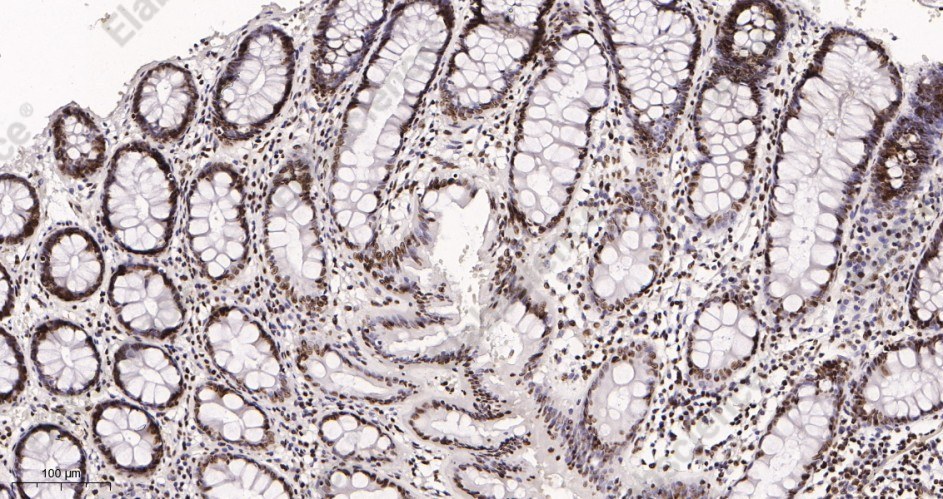 Recombinant SP1 Monoclonal Antibody - 2