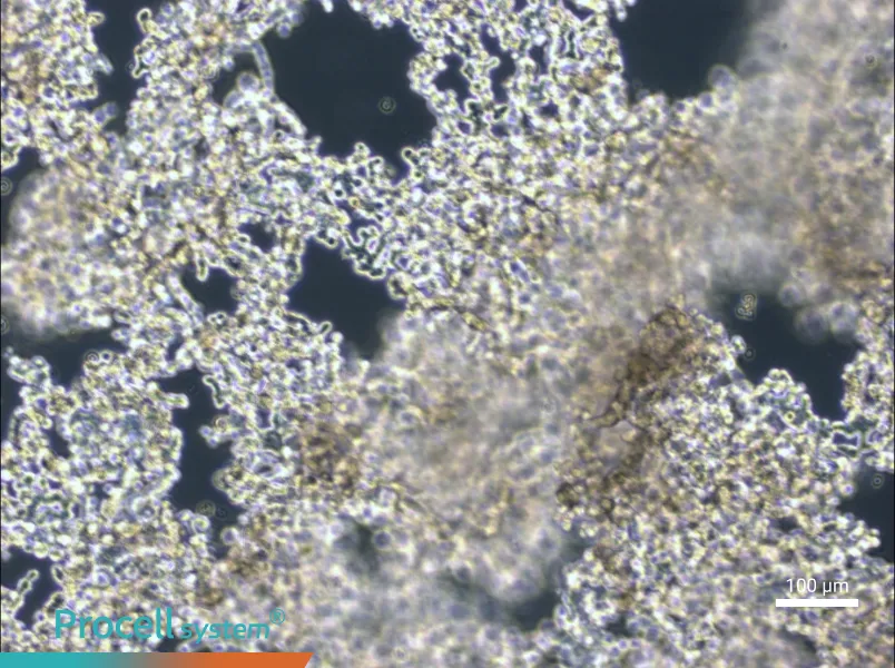 NCI-H526NCI-H526 - 3