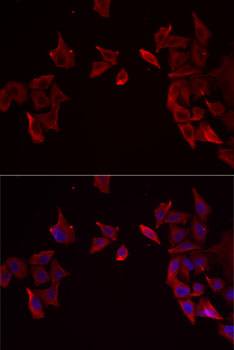 Immunofluorescence analysis of MCF7 cells using RAMP3 Polyclonal Antibody