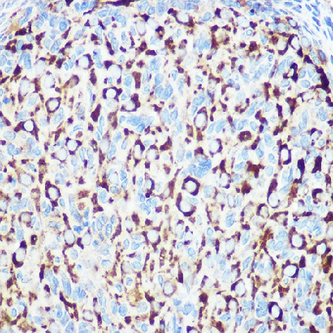 Immunohistochemistry of paraffin-embedded rat ovary using RNF126 Polyclonal Antibody at dilution of 1:100 (40x lens).Perform microwave antigen retrieval with 10 mM Tris/EDTA buffer pH 9.0 before commencing with IHC staining protocol.