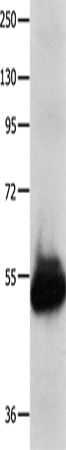 Western Blot analysis of Human kidney cancer tissue using KCNA1 Polyclonal Antibody at dilution of 1:600