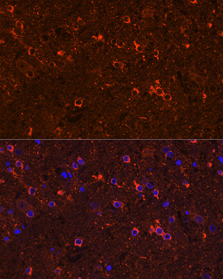 Immunofluorescence analysis of rat brain cells using GAD65/GAD2 Polyclonal Antibody at dilution of 1:100 (40x lens). Blue: DAPI for nuclear staining.