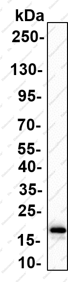 Recombinant UBC9 Monoclonal Antibody - 2