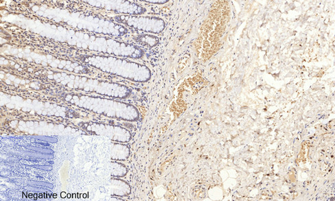 Immunohistochemistry of paraffin-embedded Human colon tissue  using Phospho-Pan-Akt (Ser473) Polyclonal Antibody at dilution of 1:200