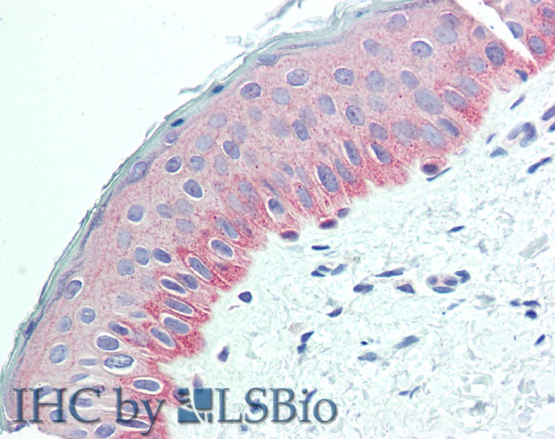 Immunohistochemistry of paraffin-embedded Human Skin using NECTIN4 Polyclonal Antibody at dilution of 1:90(Elabscience Product Detected by Lifespan).