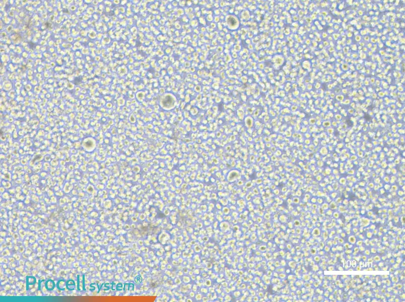 SET-2 Cell Complete MediumSET-2 Cell Complete Medium - 3