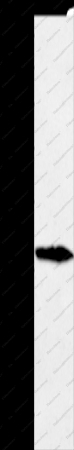 GREM1 Polyclonal Antibody - 1