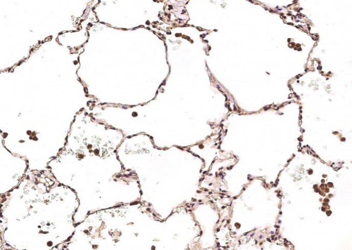 Recombinant Carbonic Anhydrase VB/CA5B Monoclonal Antibody - small - 2