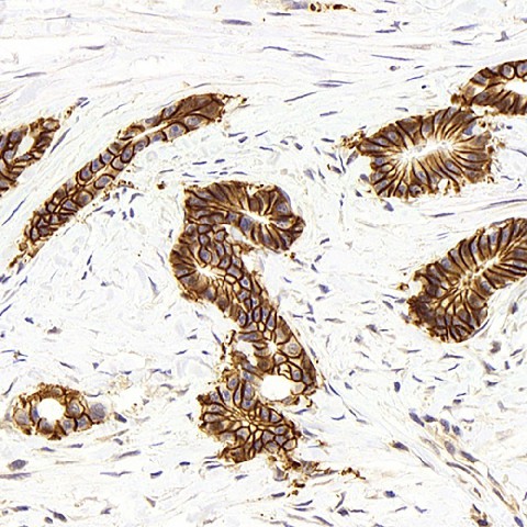 Immunohistochemistry analysis of paraffin-embedded human colon  using Na+/K+-ATPase alpha1 Polyclonal Antibody at dilution of 1:300.