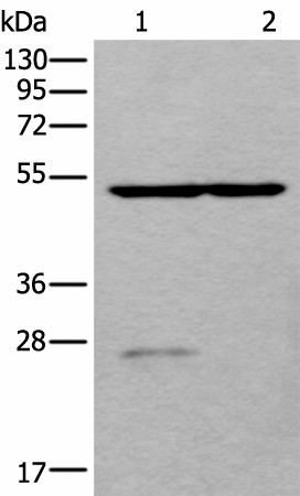 Western blot analysis of Human left kidney tissue and Human fetal liver tissue lysates  using DDC Polyclonal Antibody at dilution of 1:800