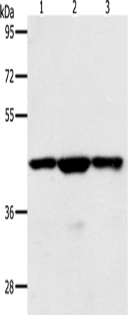 Western Blot analysis of Jurkat, hela and K562 cell using MAP2K1 Polyclonal Antibody at dilution of 1:400