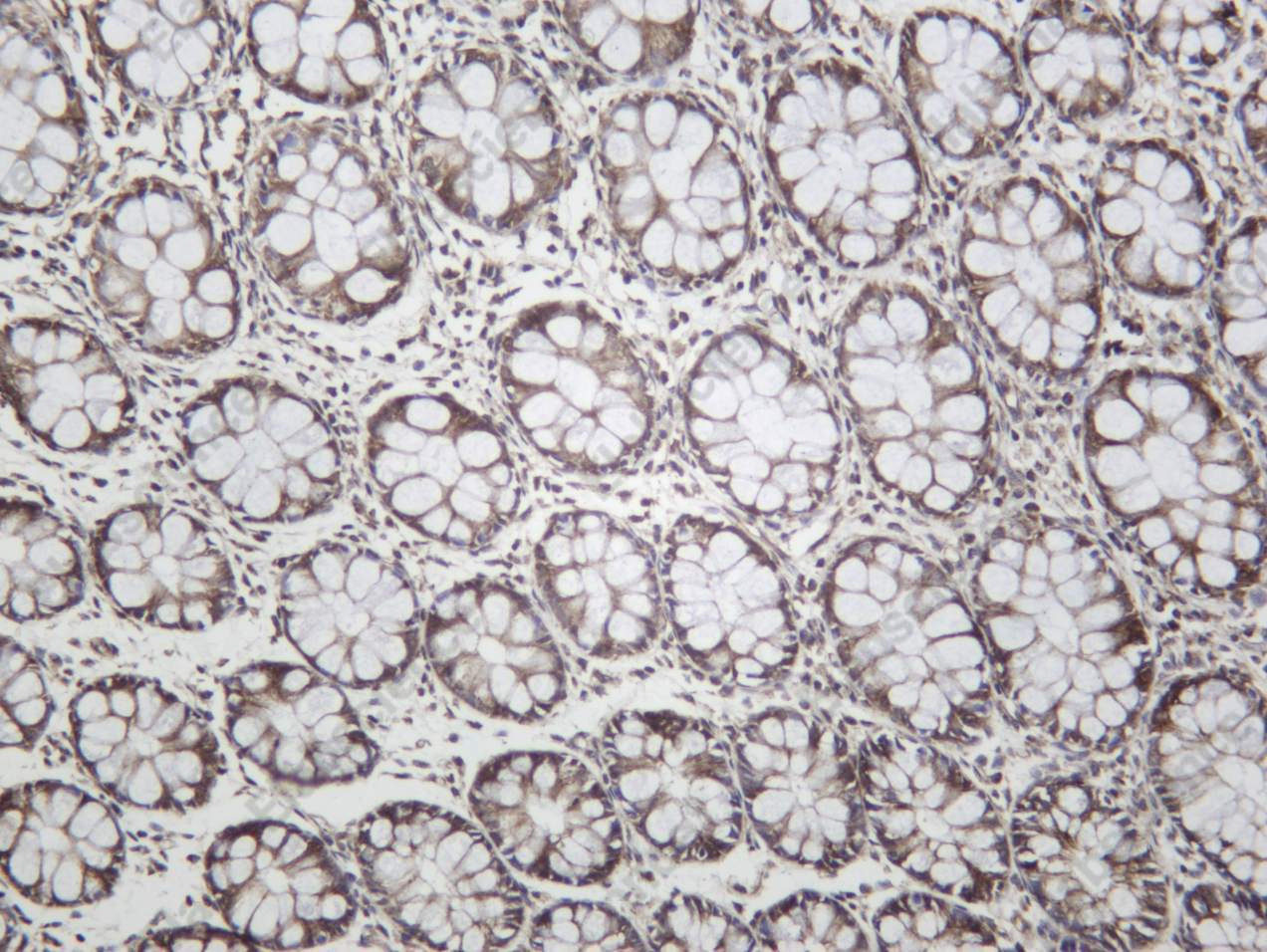 Recombinant LONP1 Monoclonal Antibody - 2