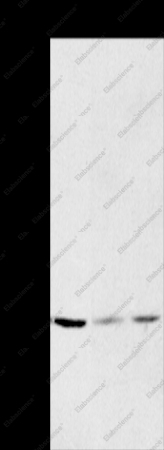 HSD17B12 Polyclonal Antibody - 1