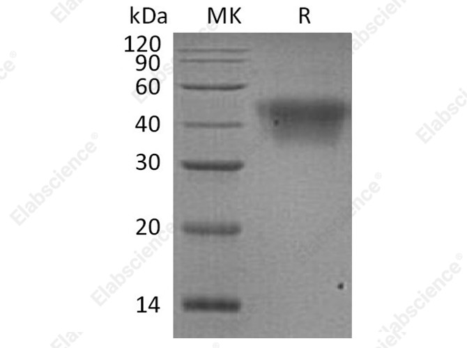Recombinant Human CD16a/FCGR3A Protein (His Tag) - 1