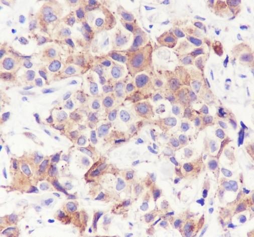 Recombinant Rab7 Monoclonal Antibody-searchlist-5