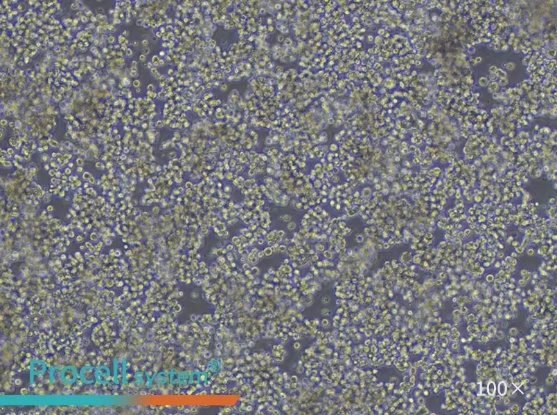 HuT 78 Cell Complete Medium - 2