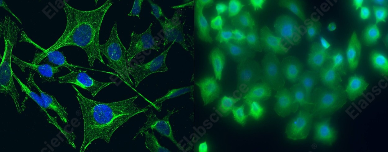 S100A5 Monoclonal Antibody - 1
