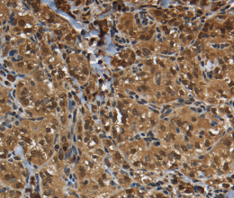 GLO1 Polyclonal Antibody - 2