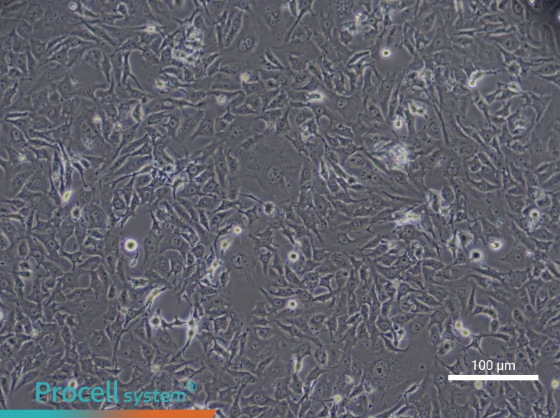 Human Type II Alveolar Epithelial (Primary cell immortalization) Cell Complete MediumHuman Type II Alveolar Epithelial (Primary cell immortalization) Cell Complete Medium - 2