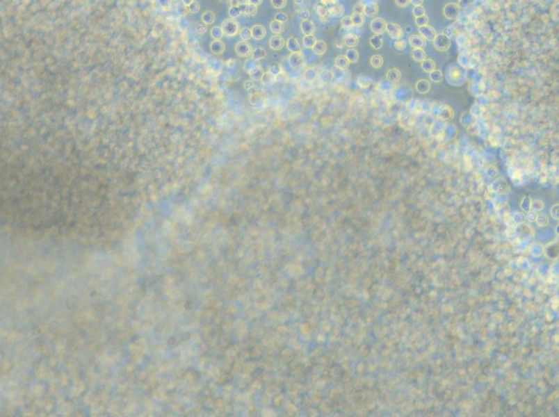 P3HR-1 Cell Complete Medium - small - 5