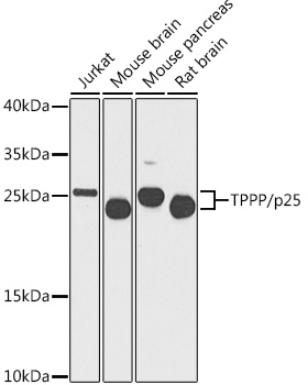 Western blot analysis of extracts of various cell lines using TPPP/p25 Polyclonal Antibody at 1:1000 dilution.