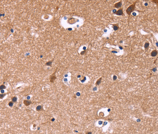 Immunohistochemistry of paraffin-embedded Human brain tissue using SIGLEC5 Polyclonal Antibody at dilution 1:30