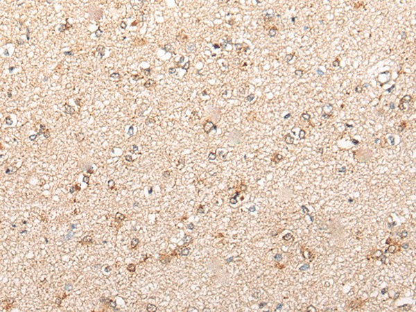 Immunohistochemistry of paraffin-embedded Human brain tissue  using CYP11B2 Polyclonal Antibody at dilution of 1:70(?200)