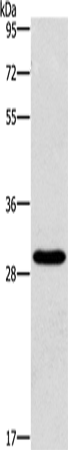 Western Blot analysis of Hela cell using BCL10 Polyclonal Antibody at dilution of 1:950