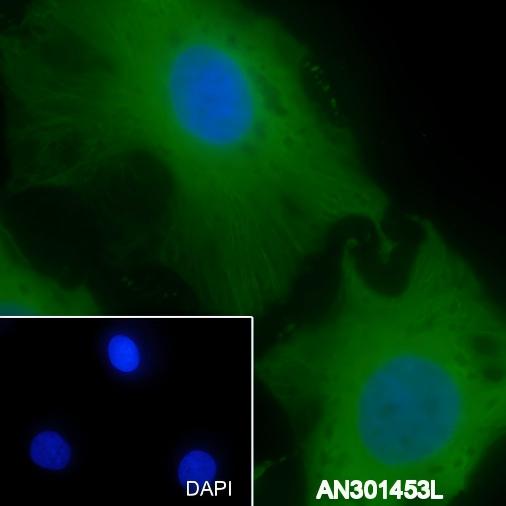 Recombinant Calpain small subunit 1 Monoclonal Antibody - small - 2