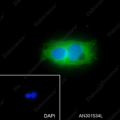 Recombinant Glypican 3 Monoclonal Antibody - 2