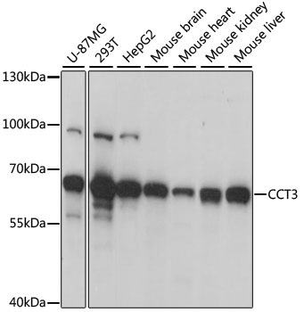 Western blot analysis of extracts of various cell lines using CCT3 Polyclonal Antibody at 1:1000 dilution.