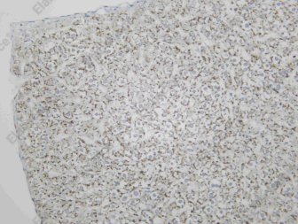 Recombinant CD155 Monoclonal Antibody - 2
