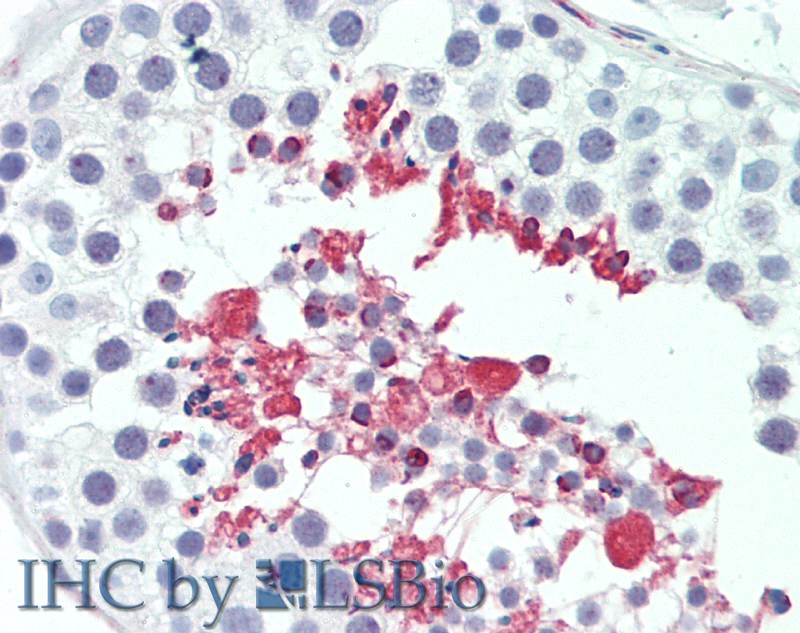 Immunohistochemistry of paraffin-embedded Testis tissue using LIPE Polyclonal Antibody at dilution of 1:100(Elabscience Product Detected by Lifespan).