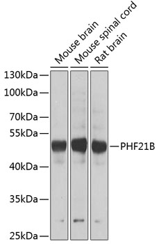 Western blot analysis of extracts of various cell lines using PHF21B Polyclonal Antibody at 1:1000 dilution.