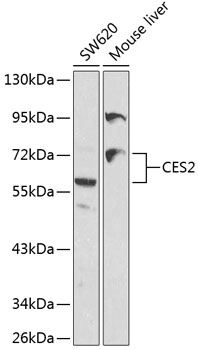 Western blot analysis of extracts of various cell lines using CES2 Polyclonal Antibody at 1:1000 dilution.