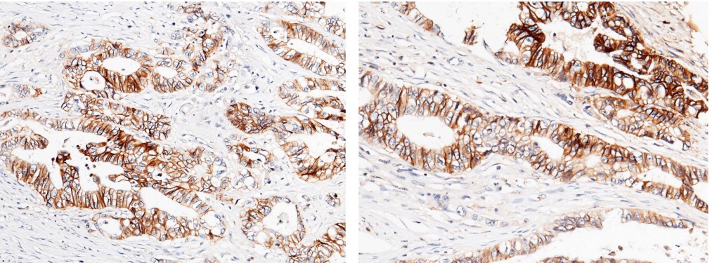 Cadherin-17/LI-cadherin/CDH17 Monoclonal Antibody - small - 1