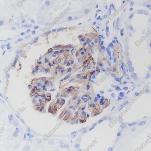Recombinant CD35 Monoclonal Antibody - 2
