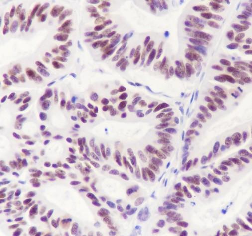 Recombinant AKT1+AKT2+AKT3 Monoclonal Antibody - 3