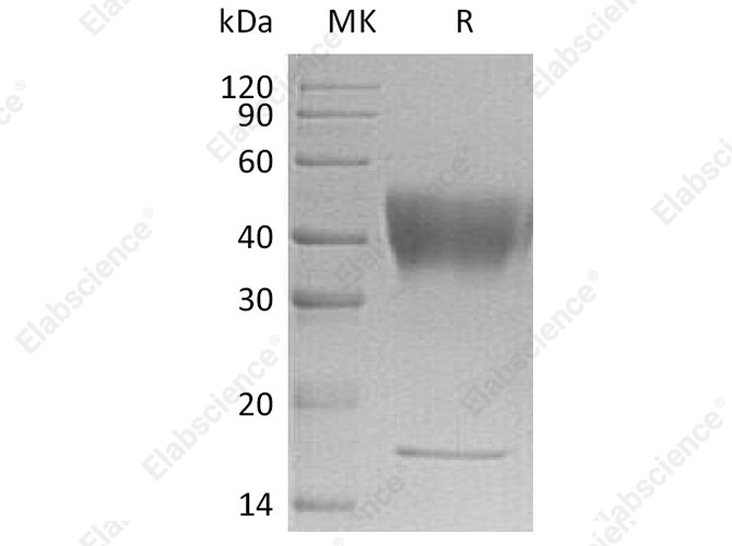 Recombinant Human IFNGR1 Protein (His Tag) - 1