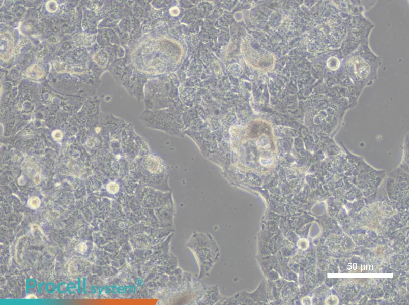 HCC1419 Cell Complete MediumHCC1419 Cell Complete Medium - 5