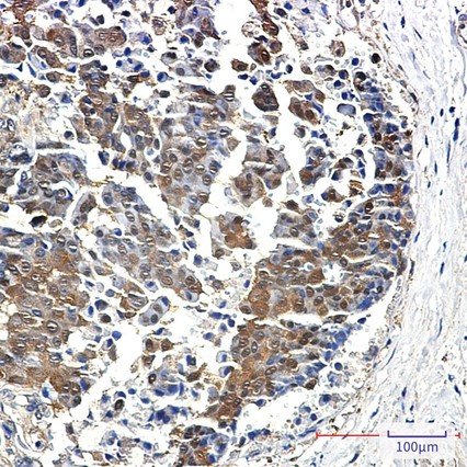 Recombinant 4E-BP1/EIF4EBP1 Monoclonal Antibody - 3