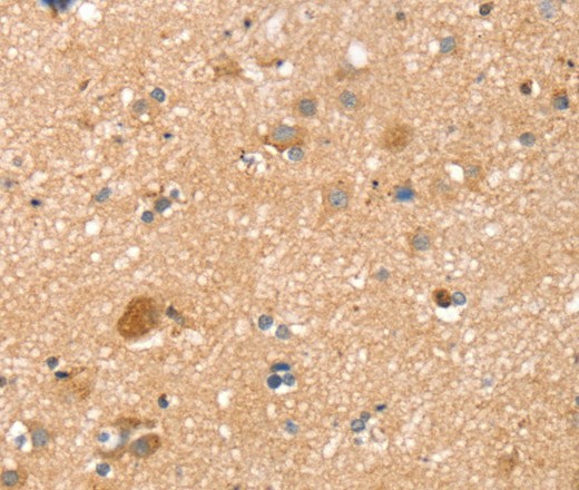 Immunohistochemistry of paraffin-embedded Human brain  tissue using TMSB10 Polyclonal Antibody at dilution 1:35