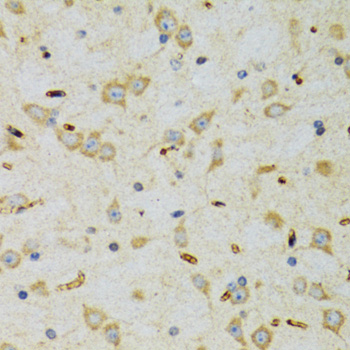 Immunohistochemistry of paraffin-embedded rat brain using SRP19 Polyclonal Antibody at dilution of 1:100 (40x lens).Perform microwave antigen retrieval with 10 mM PBS buffer pH 7.2 before commencing with IHC staining protocol.