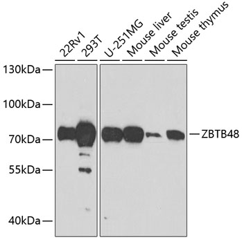 Western blot analysis of extracts of various cell lines using ZBTB48 Polyclonal Antibody at 1:1000 dilution.