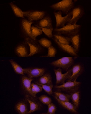 Immunofluorescence analysis of U2OS cells using ECSIT Polyclonal antibody at dilution of 100 (40x lens). Blue: DAPI for nuclear staining.