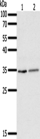 Western Blot analysis of Human fetal lung tissue and A549 cell using SFTPA1 Polyclonal Antibody at dilution of 1:300