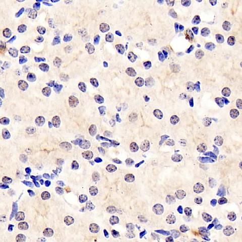 Immunohistochemistry analysis of paraffin-embedded mouse kidney  using RELB Polyclonal Antibody at dilution of 1:400.