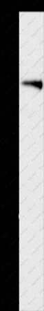 ARHGEF11 Polyclonal Antibody - 1
