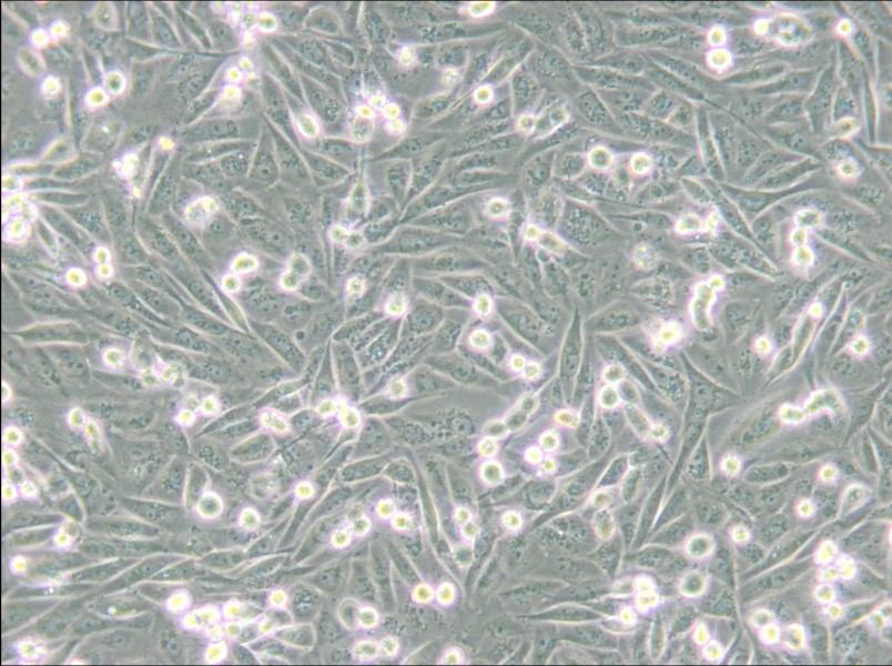 MDA-MB-231-GFP (L15) Cell Complete Medium - small - 7