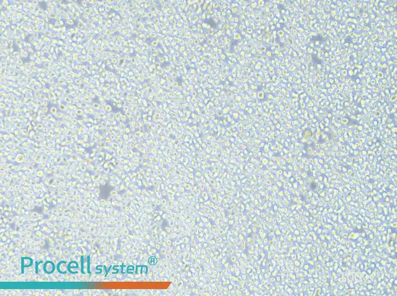 AMO1 Cell Complete MediumAMO1 Cell Complete Medium - 2